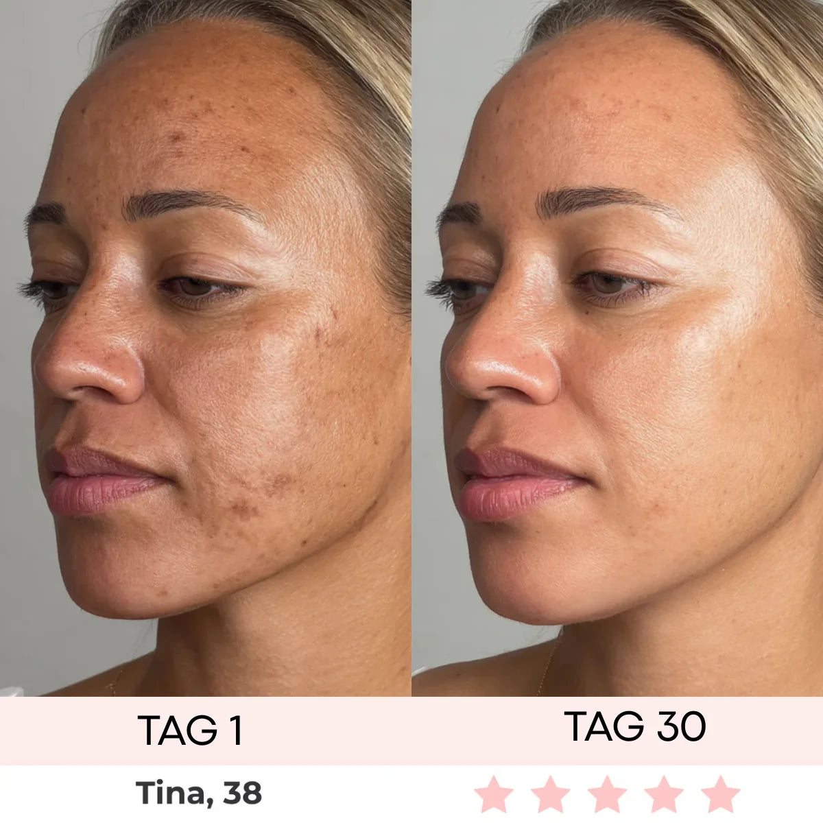 DERMASKIN | LumiSculpt LED