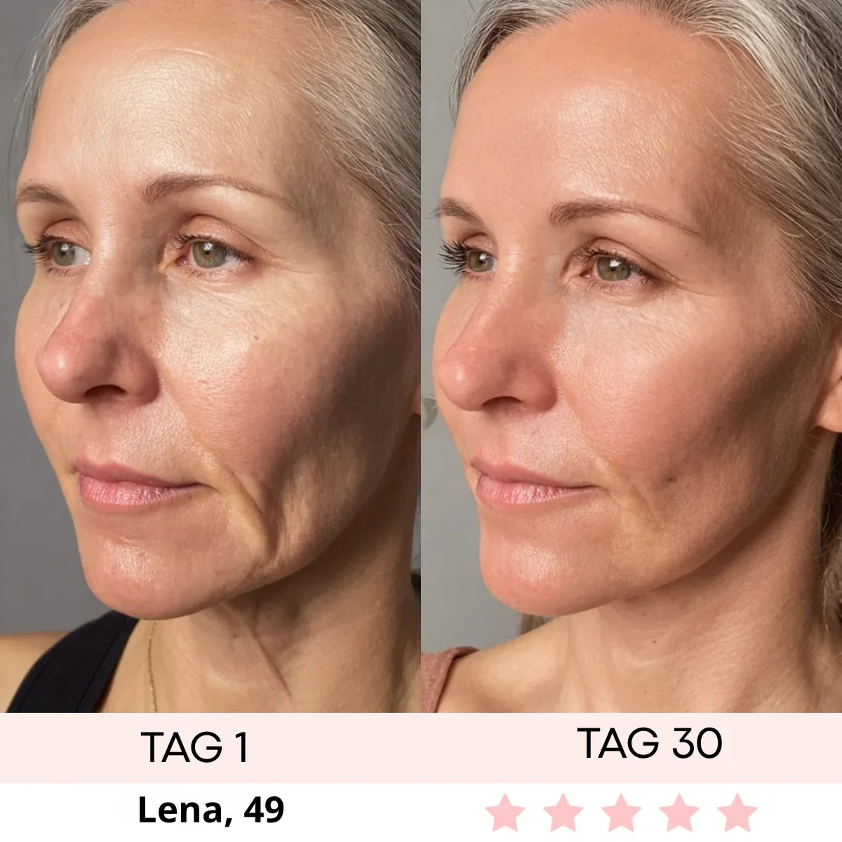 DERMASKIN | LumiSculpt LED