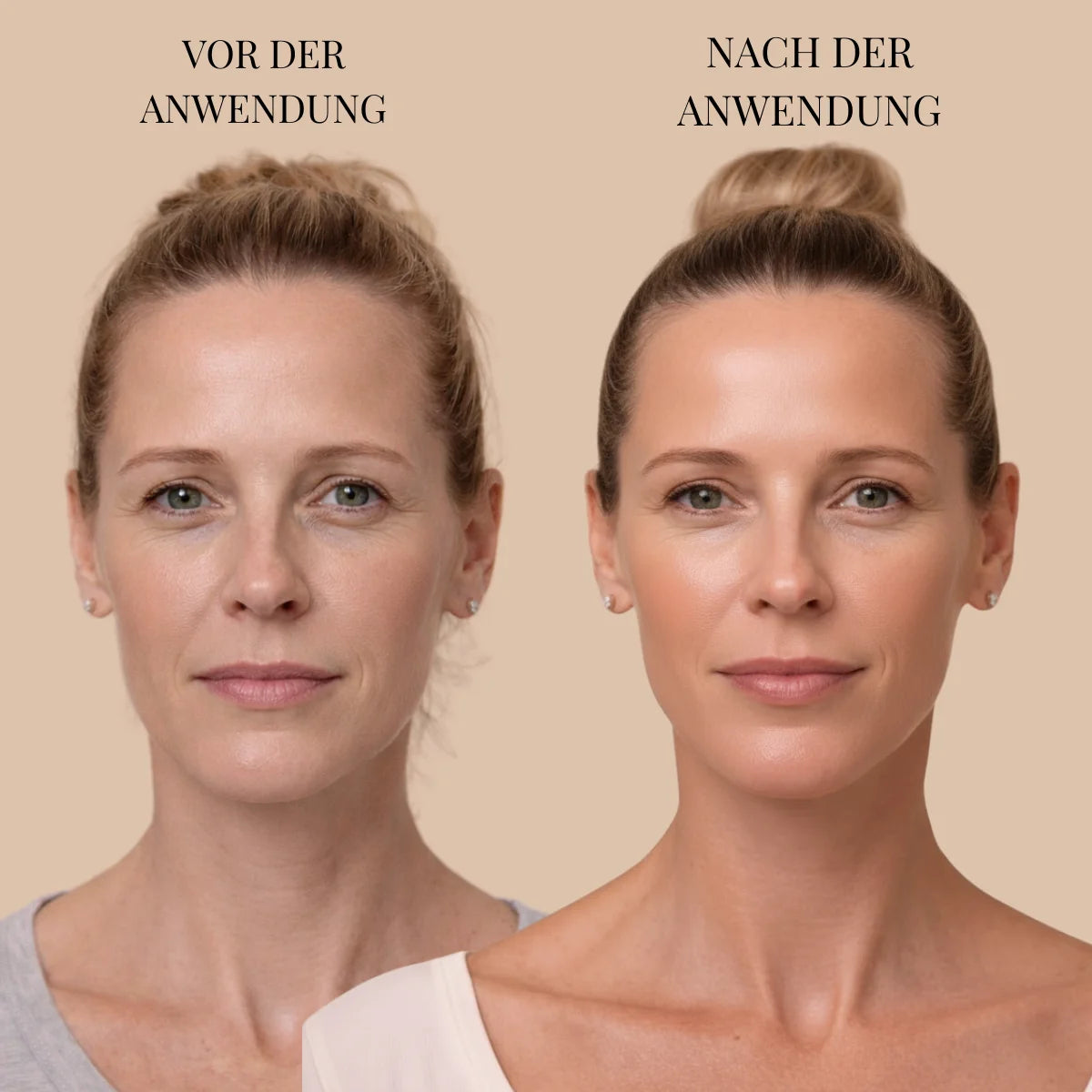 DERMASKIN | SculptLift