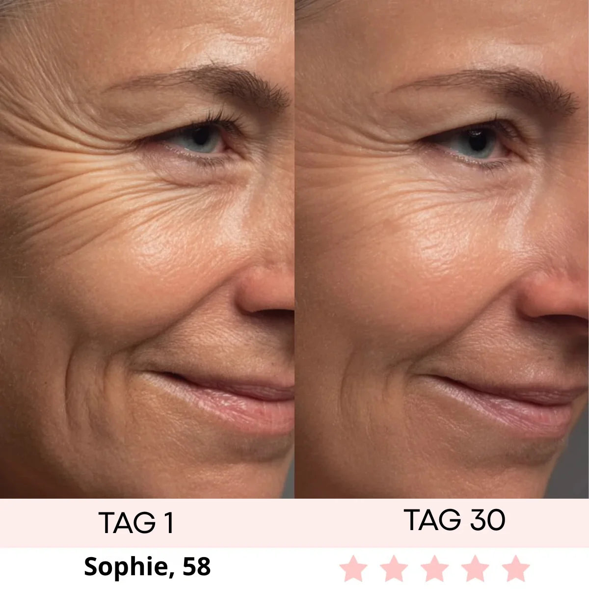 DERMASKIN | LumiSculpt LED