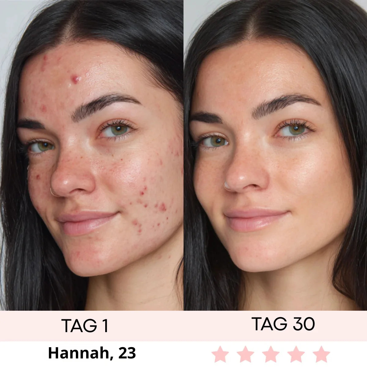 DERMASKIN | LumiSculpt LED