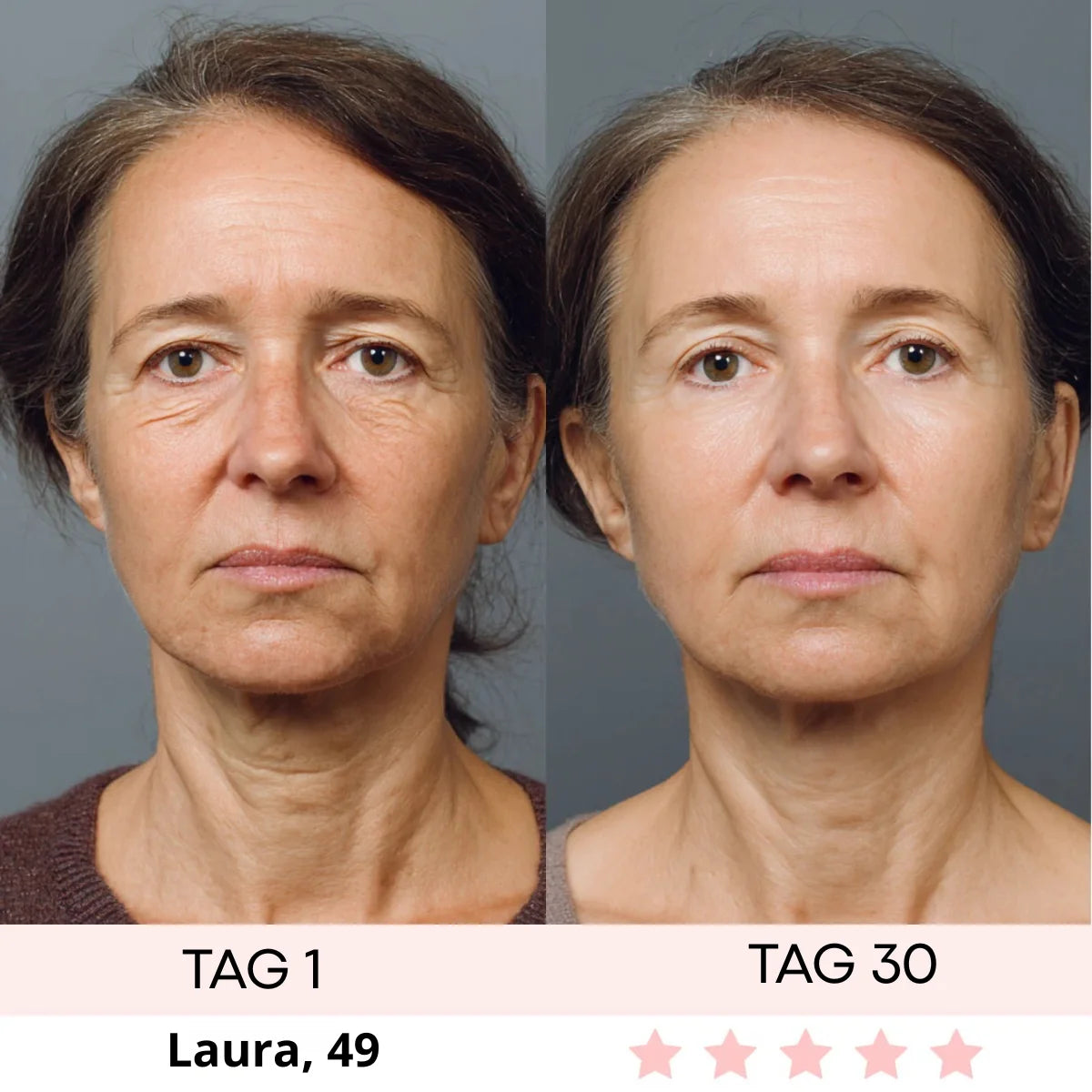 DERMASKIN | LumiSculpt LED