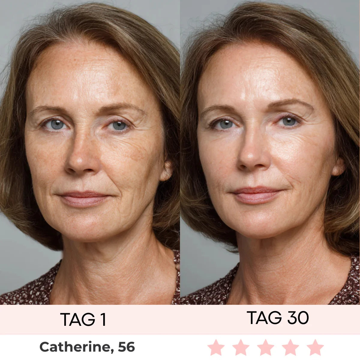 DERMASKIN | LumiSculpt LED